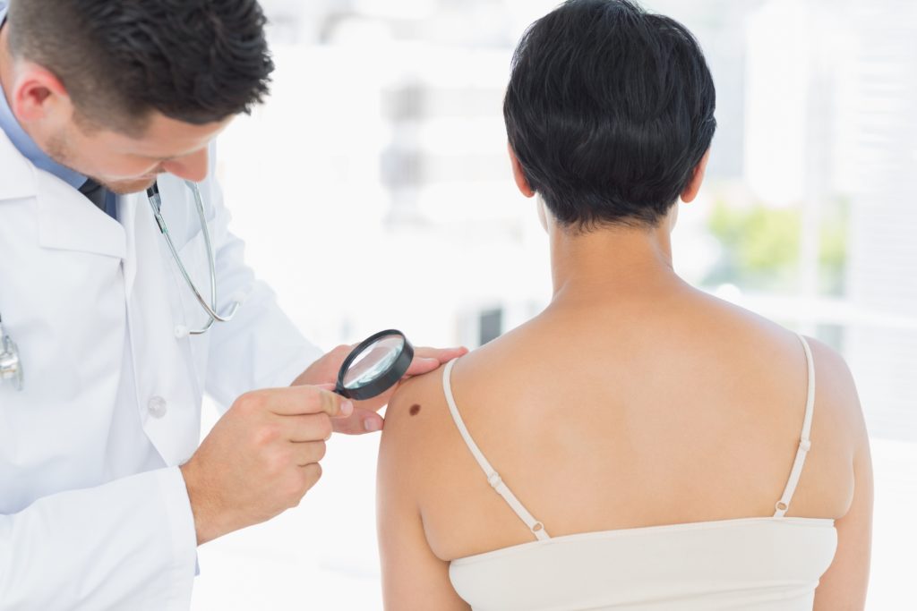 Dermatologist examining melanoma on woman