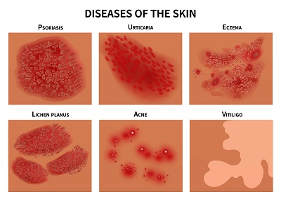 Medical dermatology - diseases of the skin overview