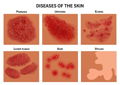 Is my skin condition a case for medical dermatology in Charlotte?