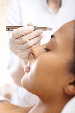 Microneedling in Charlotte NC